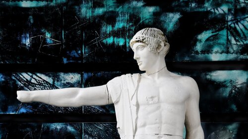 Abguss des Apollon aus dem Westgiebel des Zeustempels von Olympia, Nr. 571